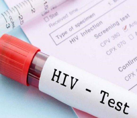 В Польщі тестуватимуть нову вакцину проти СНІДу