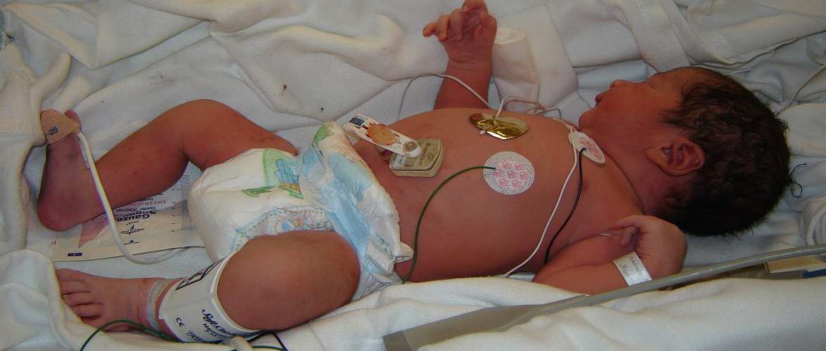 Наймолодша жертва коронавірусу в Польщі: померло 4-місячне немовля